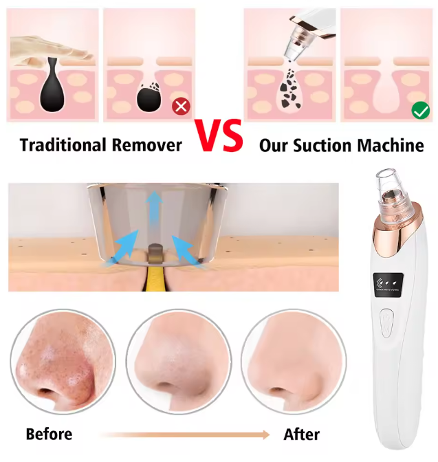 Electric Vacuum Suction Blackhead Remover