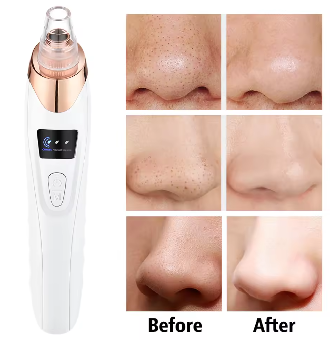 Electric Vacuum Suction Blackhead Remover