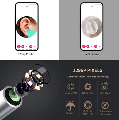 Smart Visual Ear Cleaner with Camera